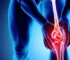 Pourquoi-quand-envisager-arthroplastie-du-genou