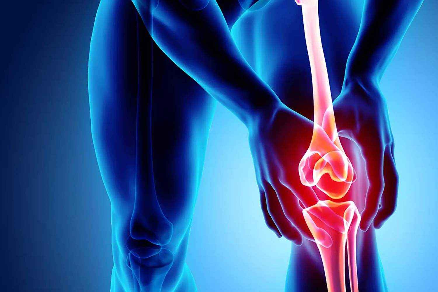 Pourquoi-quand-envisager-arthroplastie-du-genou
